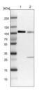 Cap-specific mRNA (nucleoside-2 -O-)-methyltransferase 1 antibody, NBP1-83046, Novus Biologicals, Western Blot image 