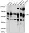 Cystathionine-Beta-Synthase antibody, GTX55551, GeneTex, Western Blot image 