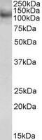 Ring Finger Protein 31 antibody, GTX89901, GeneTex, Western Blot image 