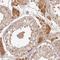 T Cell Leukemia/Lymphoma 1B antibody, HPA053163, Atlas Antibodies, Immunohistochemistry frozen image 