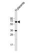 Interleukin 1 Receptor Type 1 antibody, MBS9202190, MyBioSource, Western Blot image 