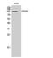 Collagen Type VI Alpha 2 Chain antibody, A03194-1, Boster Biological Technology, Western Blot image 