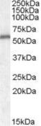 Neurotrophin 4 antibody, GTX88754, GeneTex, Western Blot image 