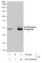 Fibrinogen Gamma Chain antibody, GTX108640, GeneTex, Immunoprecipitation image 