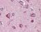 Solute Carrier Family 22 Member 17 antibody, NBP1-20975, Novus Biologicals, Immunohistochemistry paraffin image 