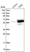 Tubulin Folding Cofactor E antibody, PA5-55343, Invitrogen Antibodies, Western Blot image 