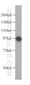 Glycogen Phosphorylase B antibody, 12075-1-AP, Proteintech Group, Western Blot image 