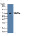 WW Domain Containing E3 Ubiquitin Protein Ligase 2 antibody, abx130629, Abbexa, Western Blot image 