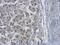 Protein Phosphatase Methylesterase 1 antibody, GTX102660, GeneTex, Immunohistochemistry paraffin image 