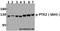 Protein Tyrosine Kinase 2 antibody, A00151S843, Boster Biological Technology, Western Blot image 