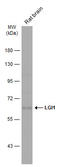 Leucine Rich Glioma Inactivated 1 antibody, GTX105700, GeneTex, Western Blot image 