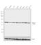 Nuclear Factor Kappa B Subunit 2 antibody, MA5-17217, Invitrogen Antibodies, Western Blot image 