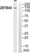 Zinc Finger And BTB Domain Containing 40 antibody, abx015008, Abbexa, Western Blot image 