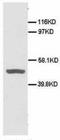 CD40 Molecule antibody, LS-C171684, Lifespan Biosciences, Western Blot image 