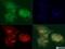 DEP Domain Containing MTOR Interacting Protein antibody, NBP1-49674, Novus Biologicals, Immunofluorescence image 