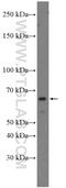 Ubiquitin Specific Peptidase 21 antibody, 17856-1-AP, Proteintech Group, Western Blot image 