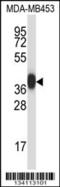 Serine Protease 8 antibody, 57-560, ProSci, Western Blot image 