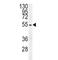 Tubulin Beta 3 Class III antibody, F49314-0.4ML, NSJ Bioreagents, Western Blot image 