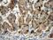 Catalase antibody, 21260-1-AP, Proteintech Group, Immunohistochemistry paraffin image 