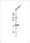 Natriuretic Peptide A antibody, MBS9204421, MyBioSource, Western Blot image 