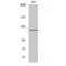 Tubulin Gamma Complex Associated Protein 5 antibody, LS-C383666, Lifespan Biosciences, Western Blot image 