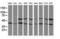 Protein Phosphatase, Mg2+/Mn2+ Dependent 1B antibody, LS-C172953, Lifespan Biosciences, Western Blot image 