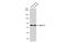 NADH:Ubiquinone Oxidoreductase Core Subunit S1 antibody, GTX113787, GeneTex, Western Blot image 