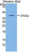 Kazal Type Serine Peptidase Inhibitor Domain 1 antibody, LS-C373755, Lifespan Biosciences, Western Blot image 