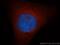 Glutathione S-Transferase Mu 5 antibody, 14502-1-AP, Proteintech Group, Immunofluorescence image 