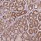 Protein Phosphatase 1 Catalytic Subunit Beta antibody, NBP2-49446, Novus Biologicals, Immunohistochemistry frozen image 