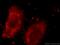 NADH:Ubiquinone Oxidoreductase Core Subunit S3 antibody, 15066-1-AP, Proteintech Group, Immunofluorescence image 