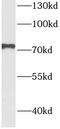 Eukaryotic Translation Initiation Factor 2 Alpha Kinase 1 antibody, FNab02690, FineTest, Western Blot image 