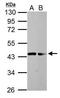 Dystroglycan 1 antibody, PA5-34908, Invitrogen Antibodies, Western Blot image 