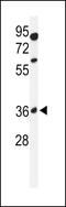 Glycosyltransferase 8 Domain Containing 2 antibody, 61-637, ProSci, Western Blot image 