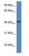 Calcium Binding Protein 39 Like antibody, NBP1-74079, Novus Biologicals, Western Blot image 