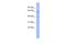 Zinc Finger Protein 689 antibody, A16987, Boster Biological Technology, Western Blot image 