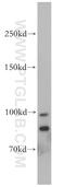 Transient Receptor Potential Cation Channel Subfamily M Member 5 antibody, 18027-1-AP, Proteintech Group, Western Blot image 