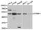 Dystrobrevin Binding Protein 1 antibody, TA327114, Origene, Western Blot image 