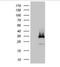 DIRAS Family GTPase 2 antibody, NBP2-46458, Novus Biologicals, Western Blot image 