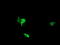 NIMA Related Kinase 11 antibody, M10929, Boster Biological Technology, Immunofluorescence image 