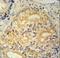 Methyltransferase Like 26 antibody, LS-C166976, Lifespan Biosciences, Immunohistochemistry paraffin image 