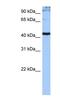 Serine And Arginine Rich Splicing Factor 6 antibody, NBP1-57112, Novus Biologicals, Western Blot image 