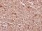 Creatine Kinase, M-Type antibody, GTX66650, GeneTex, Immunohistochemistry paraffin image 