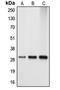 NAD(P)HX Epimerase antibody, LS-C353628, Lifespan Biosciences, Western Blot image 