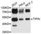 TIMELESS Interacting Protein antibody, abx126705, Abbexa, Western Blot image 