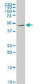 Netrin G2 antibody, LS-B4540, Lifespan Biosciences, Western Blot image 