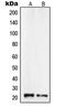 Regulator Of Calcineurin 1 antibody, MBS822319, MyBioSource, Western Blot image 