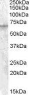 Insulin Like Growth Factor 2 MRNA Binding Protein 2 antibody, PA5-18865, Invitrogen Antibodies, Western Blot image 