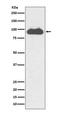 Transferrin Receptor antibody, M00591-1, Boster Biological Technology, Western Blot image 