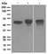 Immunoglobulin Heavy Constant Alpha 1 antibody, ab124716, Abcam, Western Blot image 